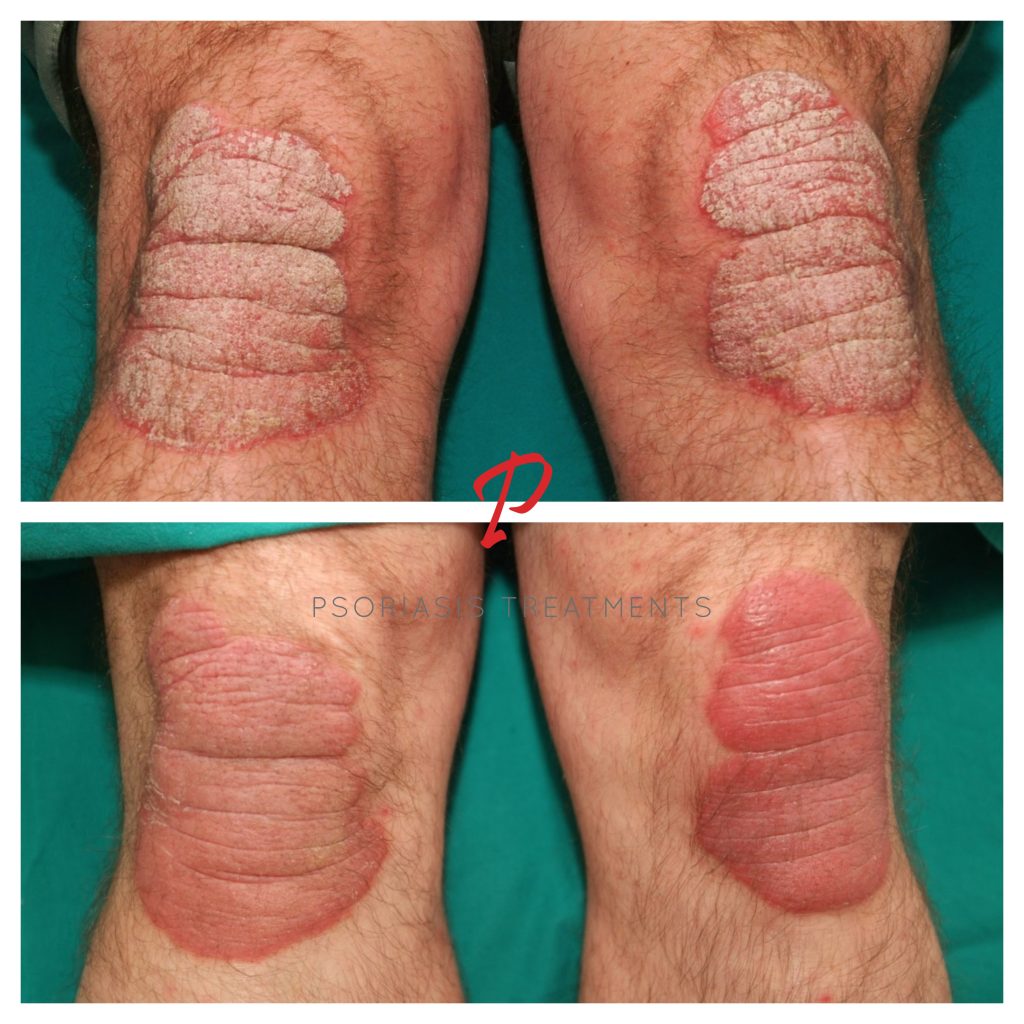03 Before & After