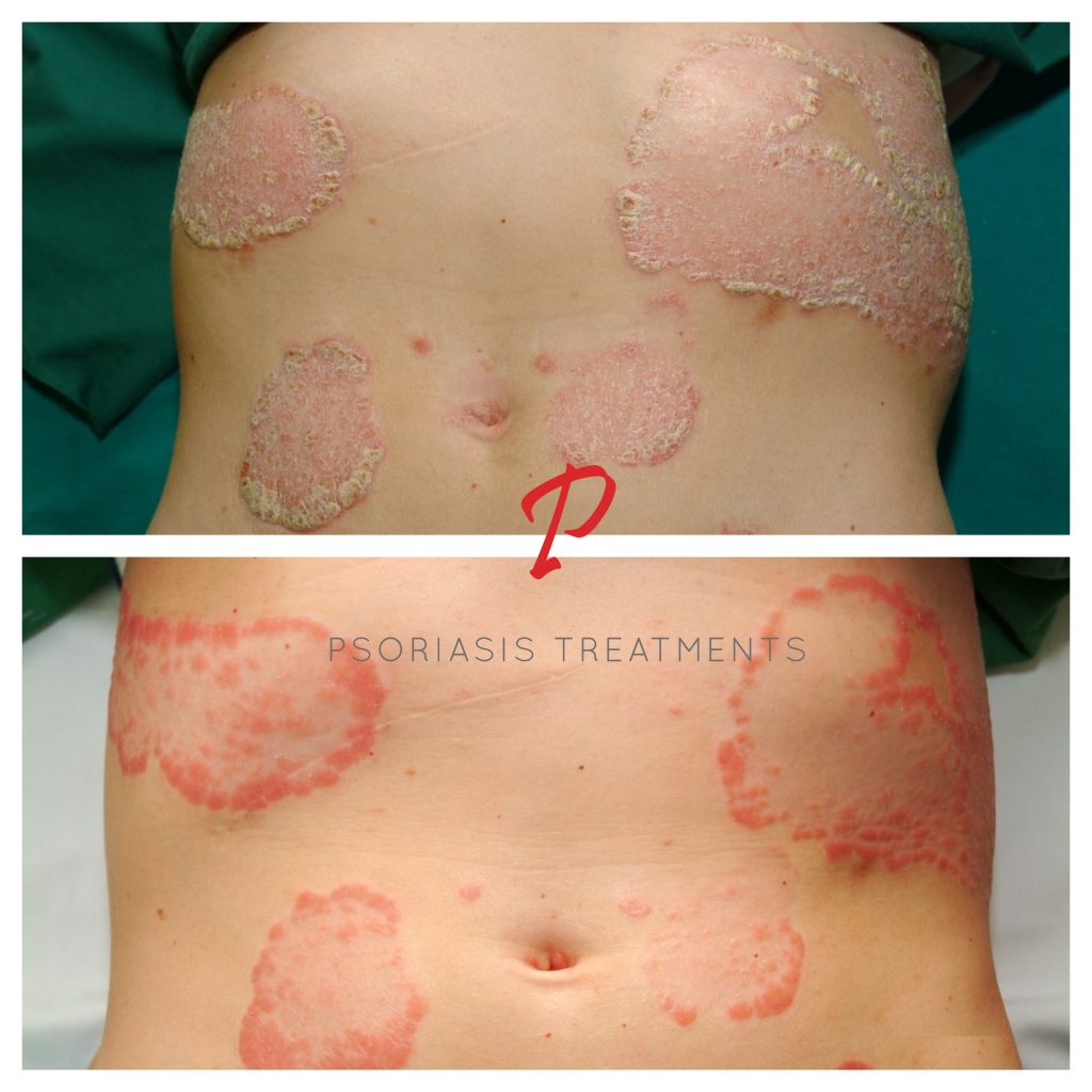 04 Before & After