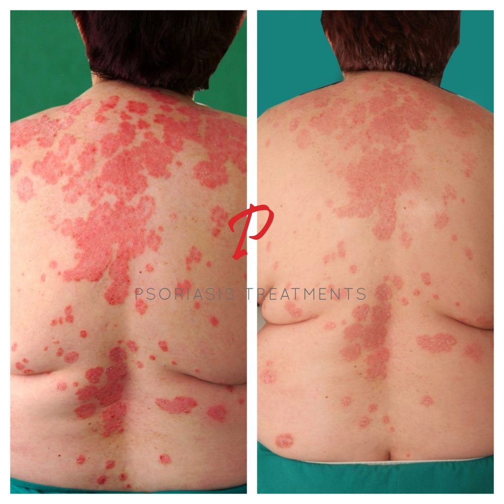 09 Before & After