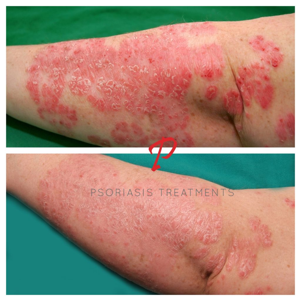 12 Before & After