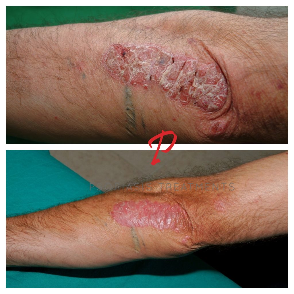 13 Before & After