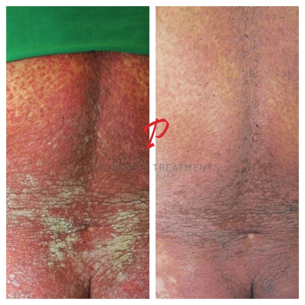19 Before & After