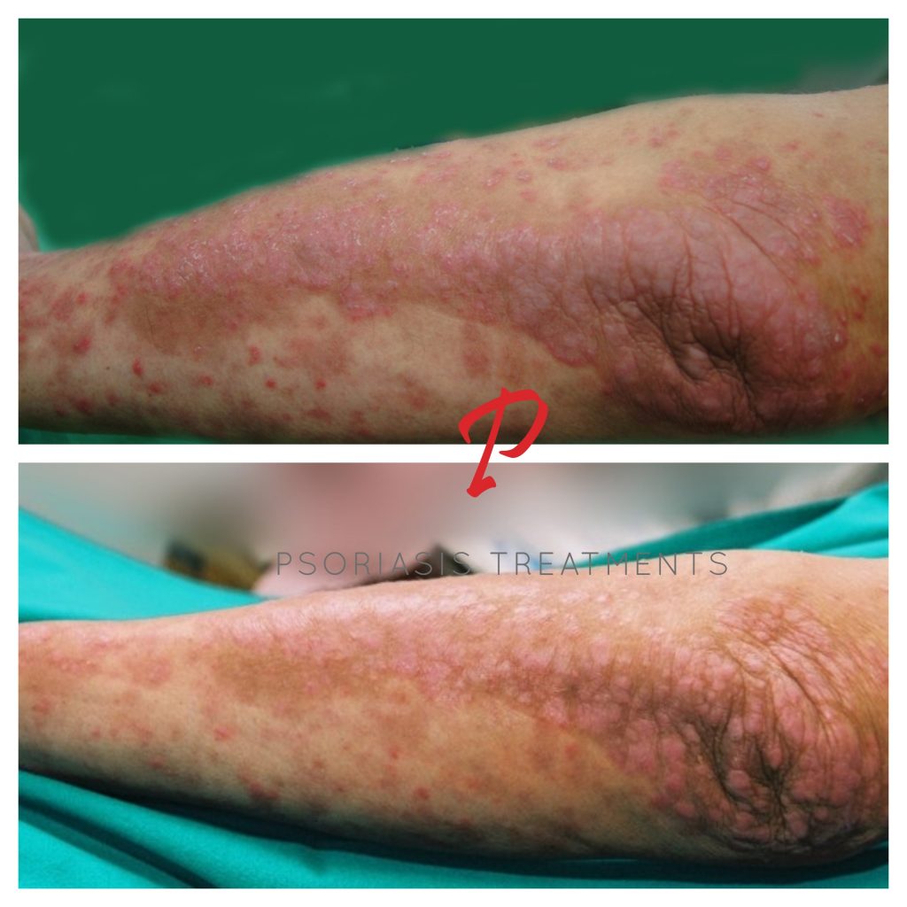 21 Before & After