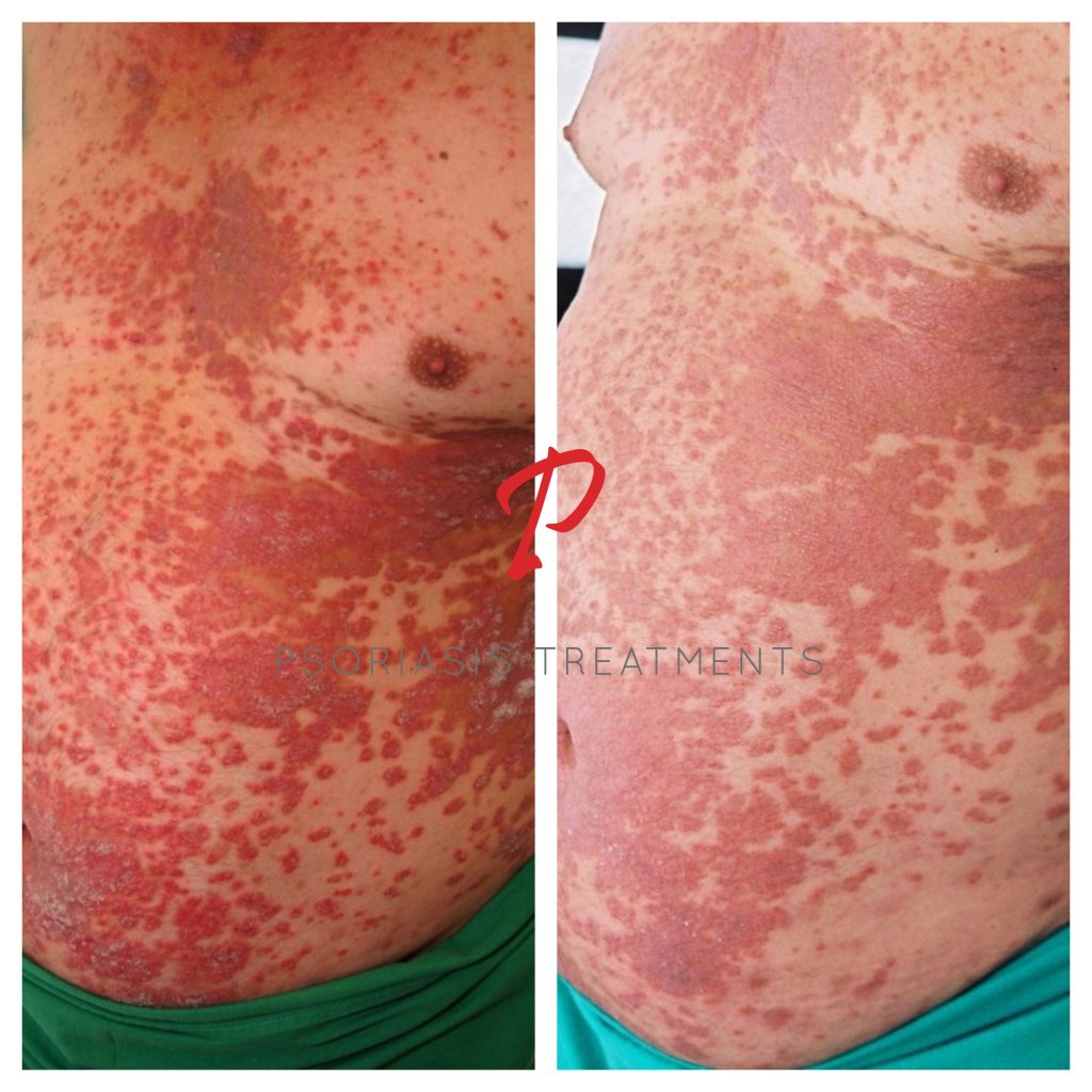 23 Before & After