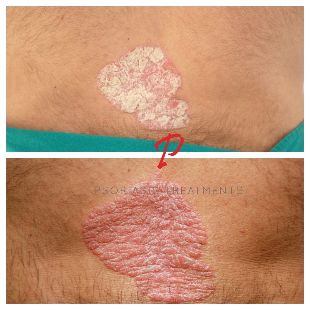 25 Before & After