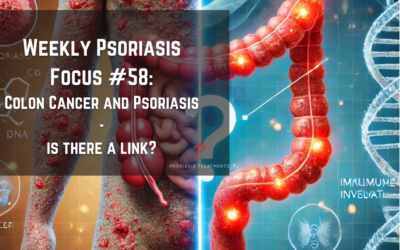 Could There Be a Link Between Colon Cancer and Psoriasis?