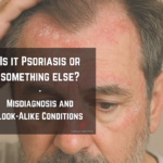 Psoriasis-like red, inflamed skin rash close-up for diagnosis comparison