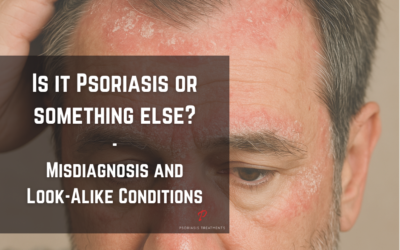 Is It Psoriasis or Something Else? Understanding Misdiagnosis and Look-Alike Conditions