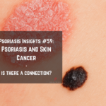 Psoriasis patch and dark mole with text overlay about psoriasis and skin cancer connection