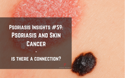 When Two Worlds Collide: Psoriasis and Skin Cancer